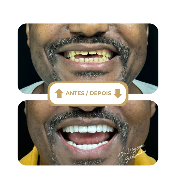 Resultado antes e depois 9